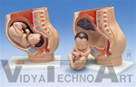 Pregnancy Pelvis, 3 part